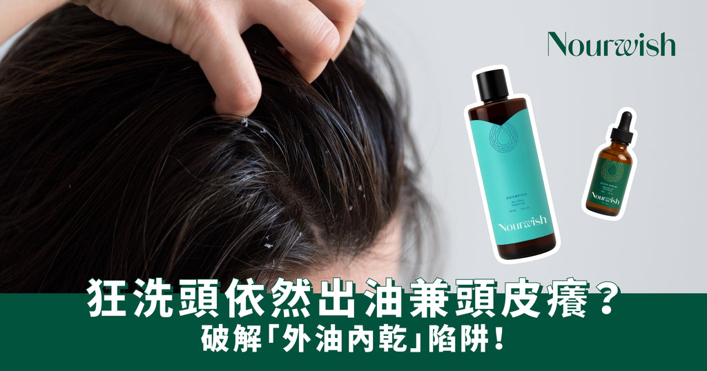 狂洗頭依然出油兼頭皮癢?破解「外油內乾」陷阱,告別頭皮屑斷尾指南