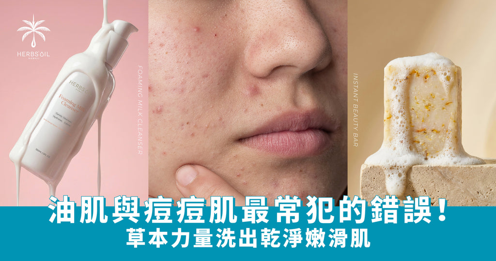 草本力量洗出乾淨肌:油肌、痘痘肌必知嘅天然清潔成分指南
