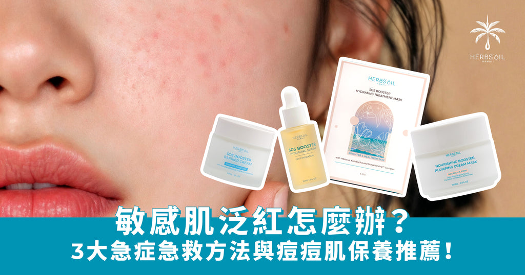 敏感肌泛紅怎麼辦？三大急症急救方法與痘痘肌保養推薦
