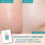 SOS最佳面膜 抗醣煥肌3盒套裝