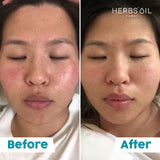 SOS最佳面膜 抗醣煥肌3盒套裝