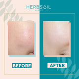 SOS Booster 抗污保濕面膜 SOS Booster Hydrating treatment Mask, 急救護膚